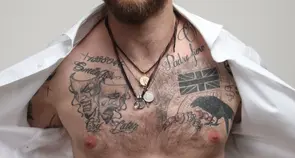 Tudo o que você precisa saber sobre remoção de tatuagem