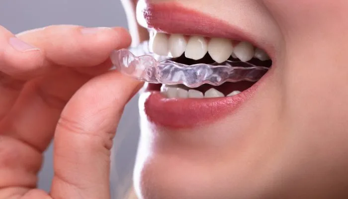 alinhador transparente