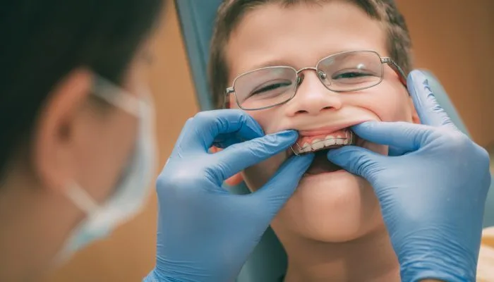 aparelho ortodôntico móvel